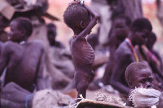 Starving Children